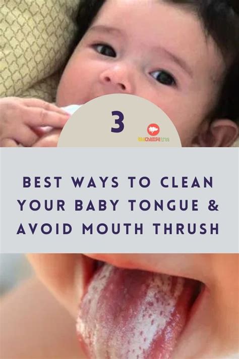 How to clean newborn tongue - Baby tongue white remove, (Pull Straight, don't slice the tongue.)